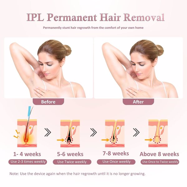 IPL Laser Hair Removal for Women and Men - laser hair removal for women permanent 999,999 Flashes Painless Hair Remover with Ice-Cooling on Armpits Back Legs Arms and Face