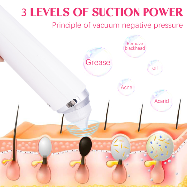 Vacuum Blackhead Remover with 6 Suction Heads, WIFI Visible Facial Pore Cleanser with HD Camera  USB Rechargeable Electric Black head Suction Tool(No Shipment on Weekends)