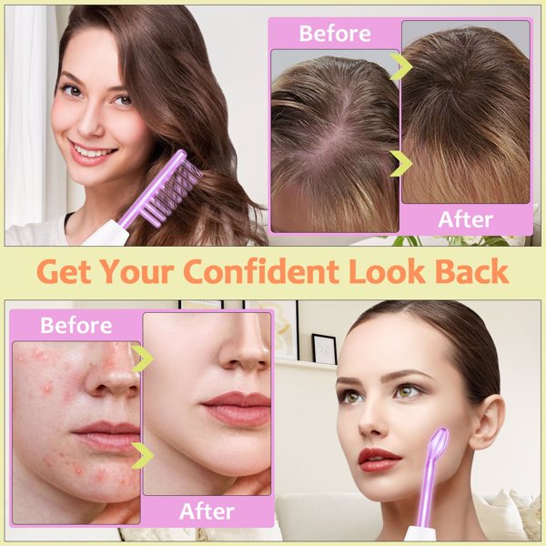 High Frequency Wand “C Violet Portable Skin Therapy Machine for Anti-Aging - Skin Tightening - Wrinkle Reducing - Dark Circles - 4 in 1